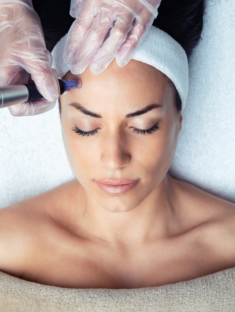 microneedling houston
