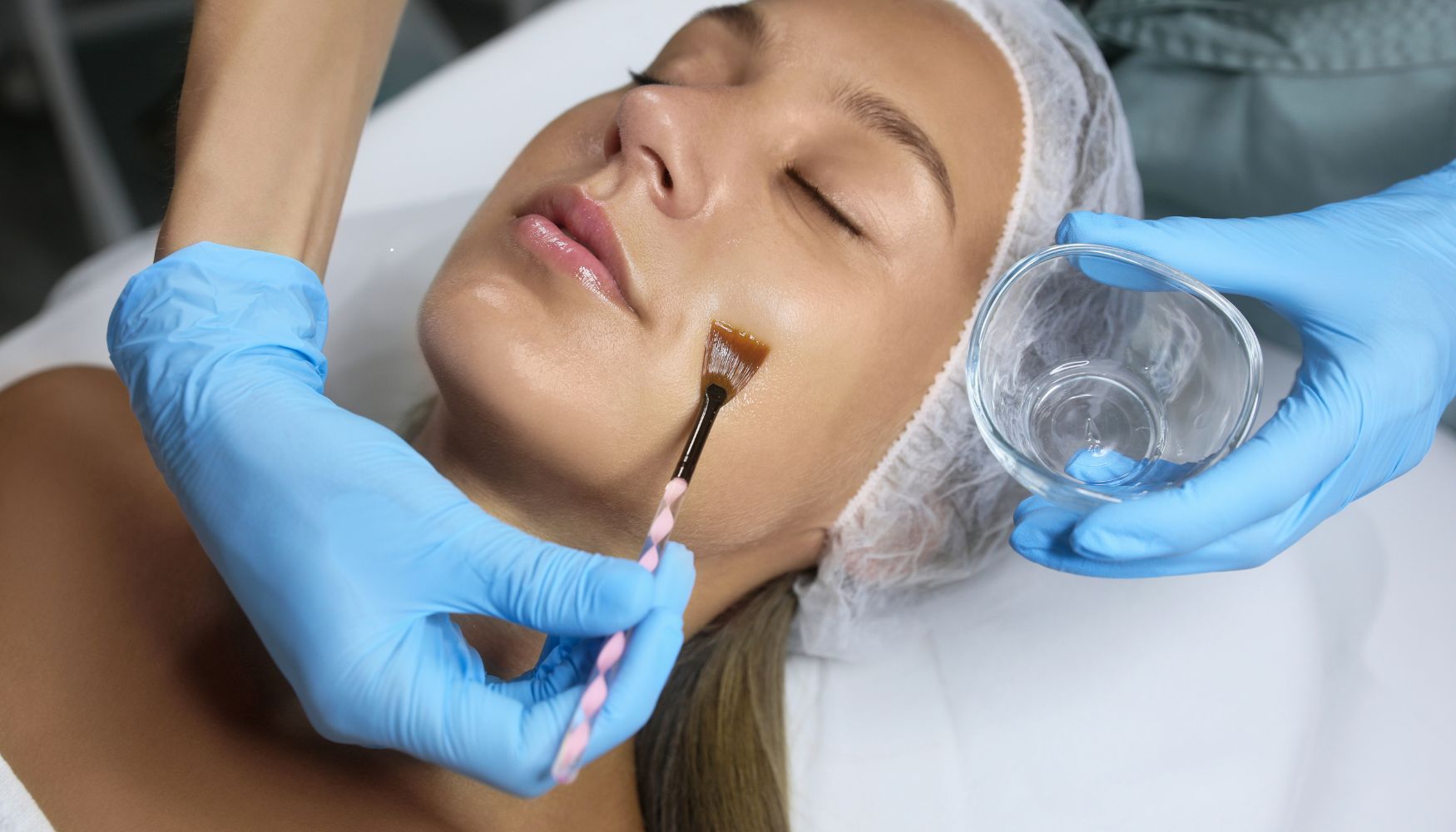 chemical peel houston tx