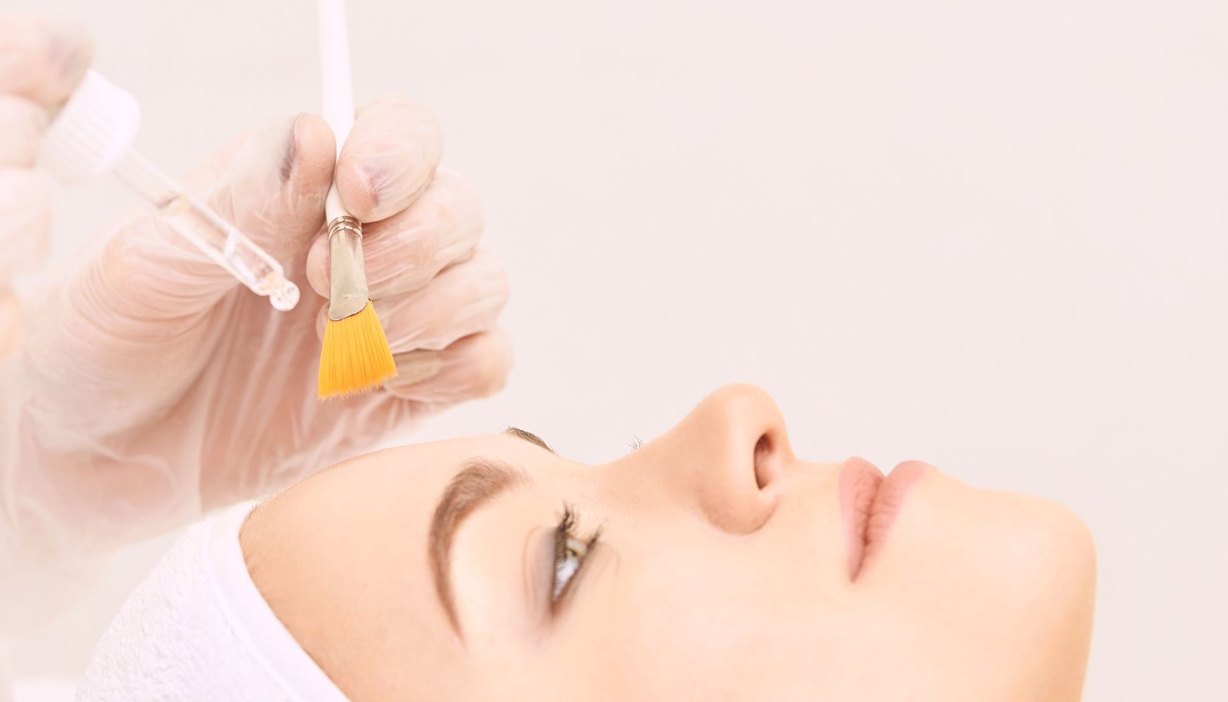 chemical peels houston